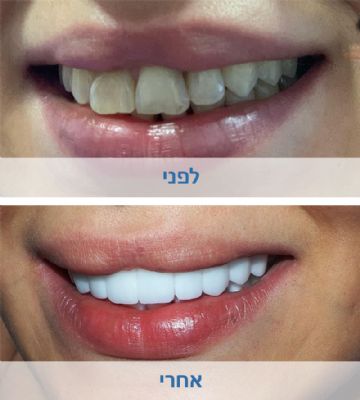 שיקום הפה